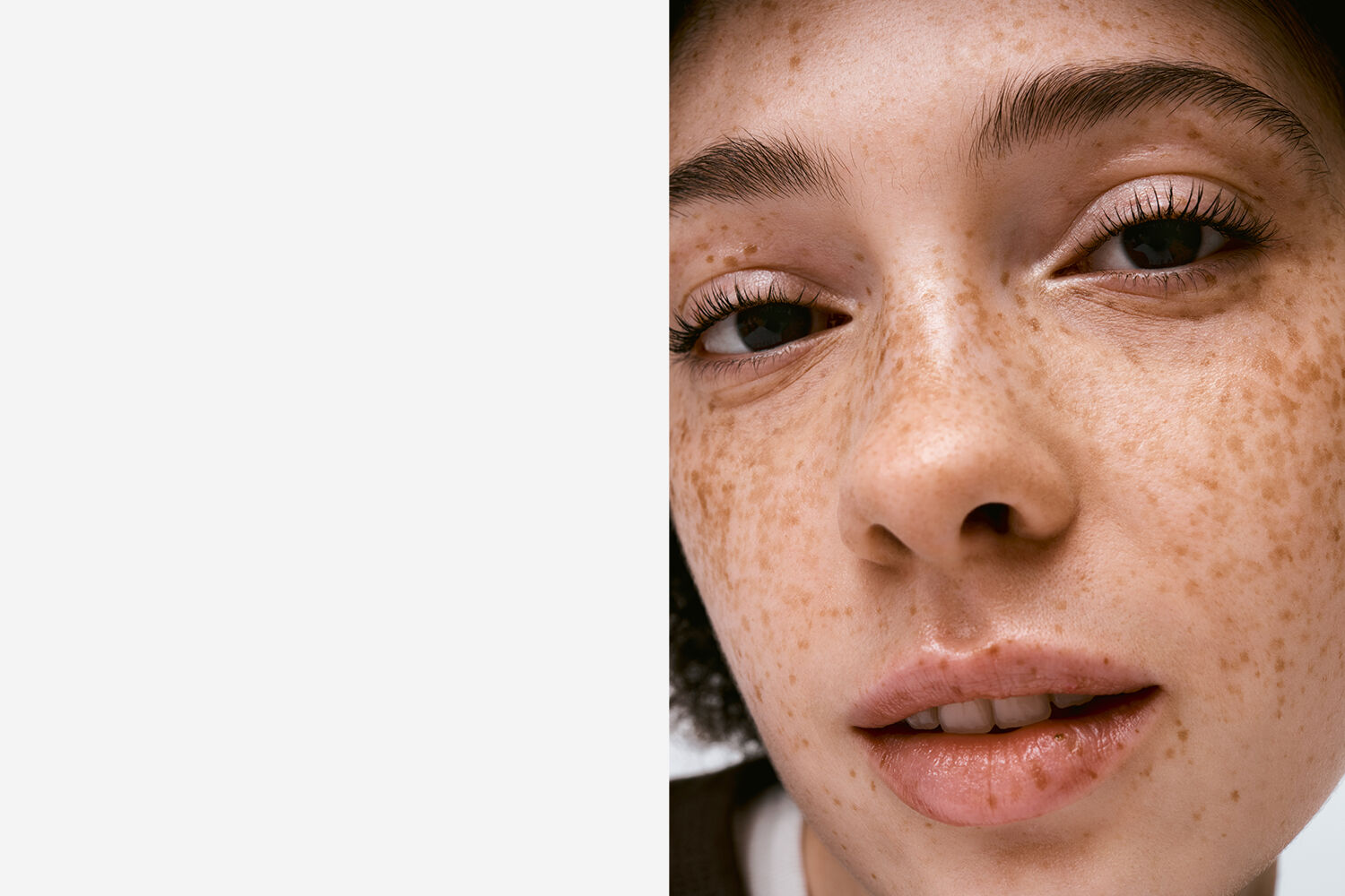 lady with blemishes on skin