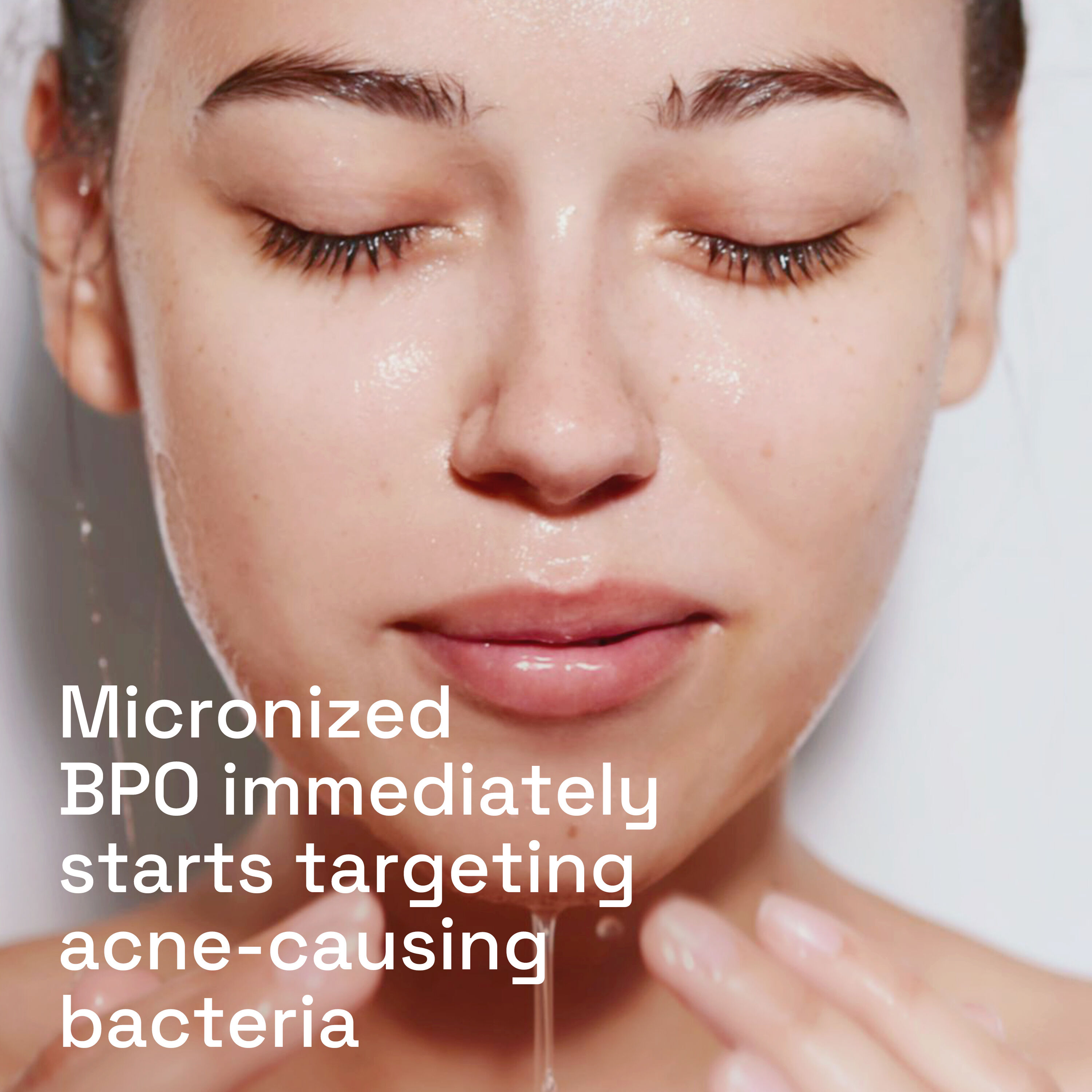 Gentle Clear Complexion Clearing Acne Cleanser