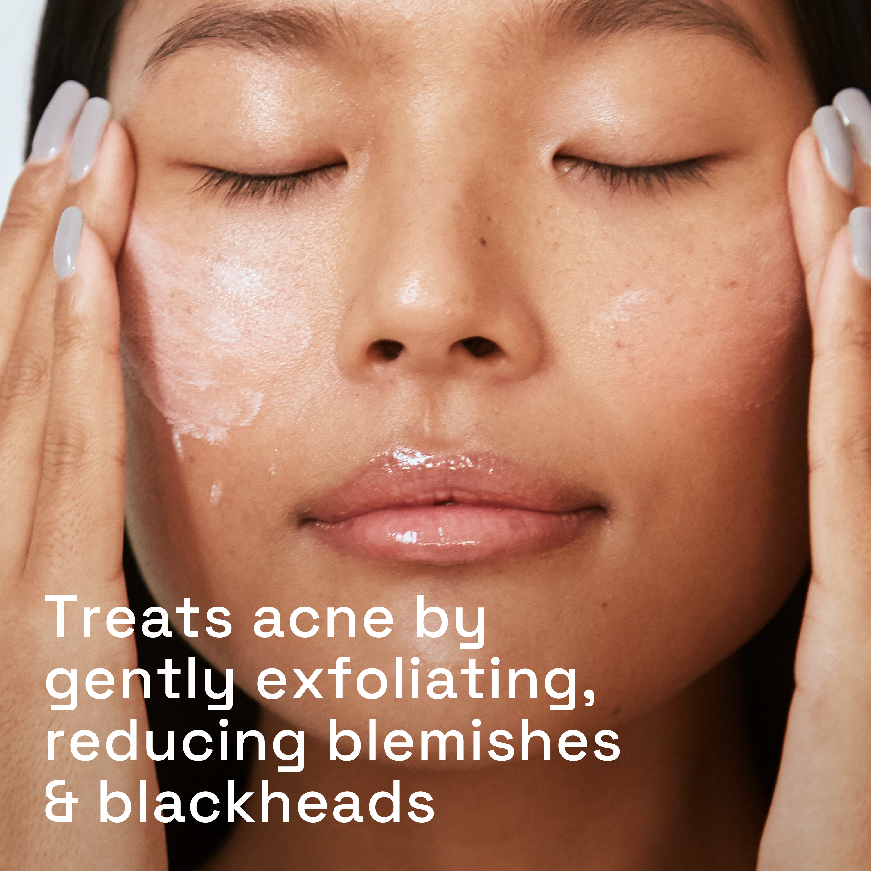 Gentle Clear Pore Clearing Acne Cleanser