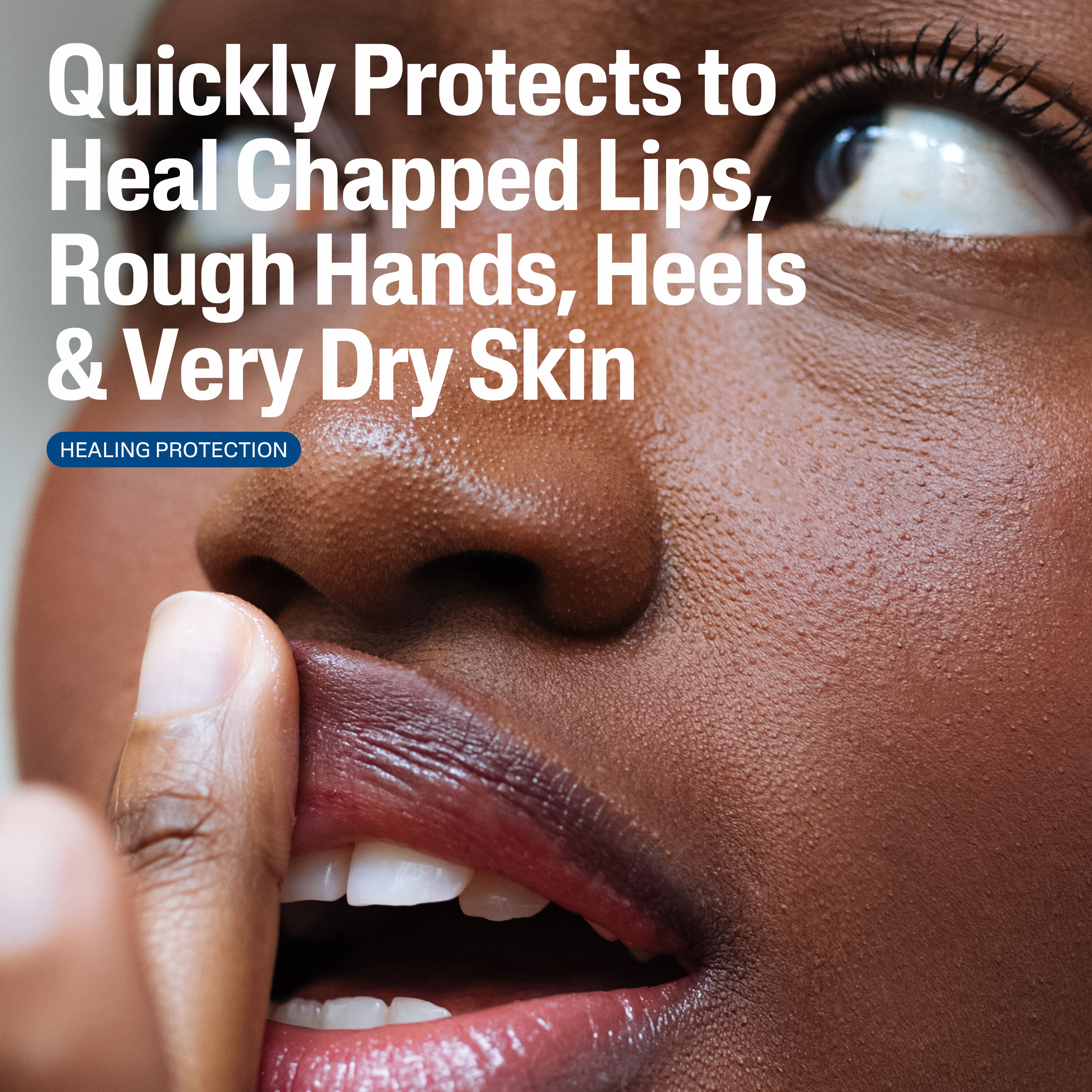 Multi-Purpose Ointment