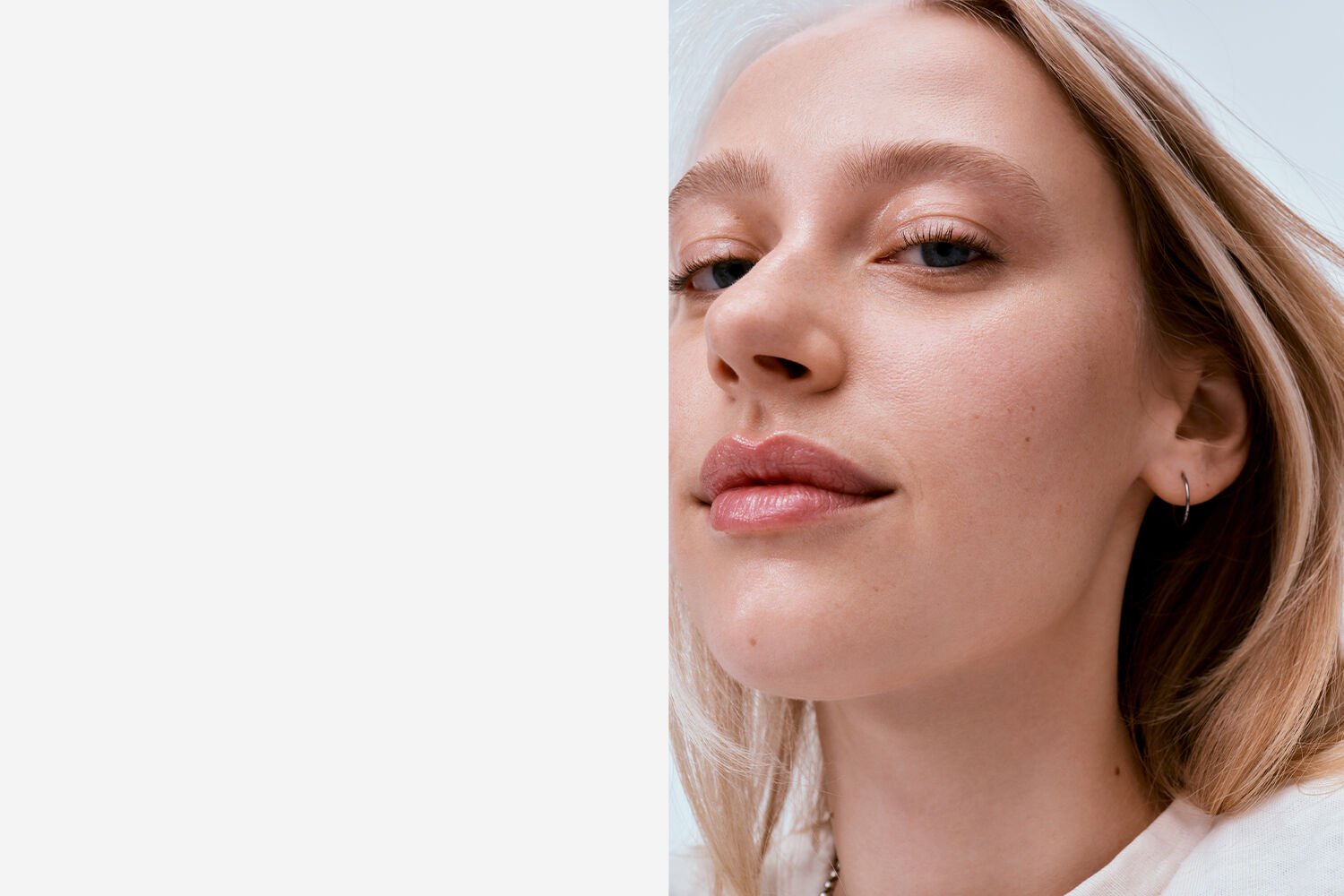 model with dry skin